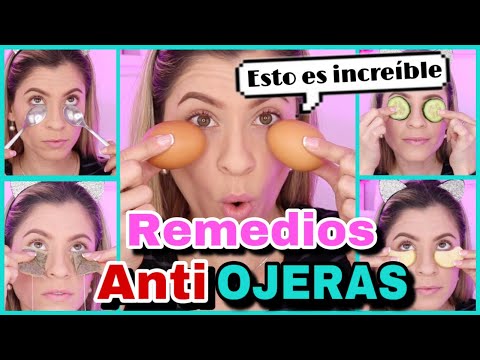 Cómo atenuar las ojeras: 5 métodos naturales