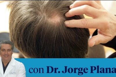 Noni para el cabello: ¿funciona para frenar la caída excesiva?
