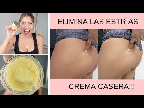 Crema casera con vitamina E para la estrías