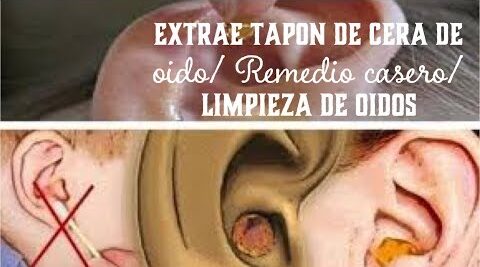 Pasos y cuidados para limpiar la cera de oídos con agua oxigenada