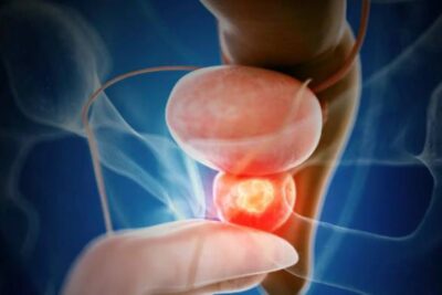 Orgasmo de Próstata Qué Es y Cómo Producirlo de Forma Segura