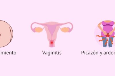 Se Puede Tener Alergia al Semen Lo Que Debes Saber