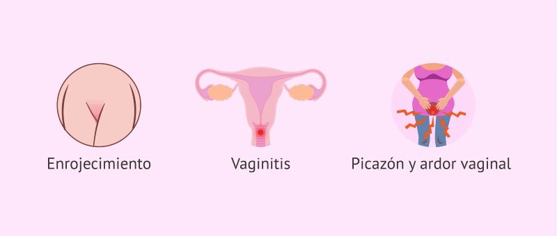 Se Puede Tener Alergia al Semen Lo Que Debes Saber