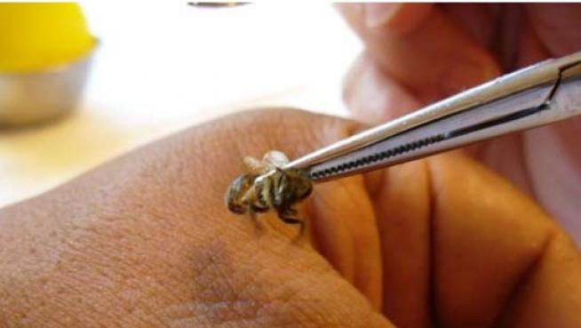 Tratamiento de apiterapia con miel, propóleo y veneno de abeja, ilustrando sus beneficios naturales.