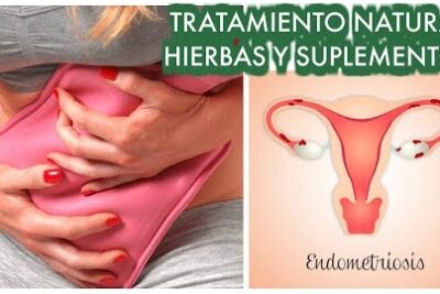 9 plantas medicinales que ayudan en la endometriosis