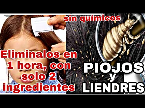 ¿Cómo eliminar las liendres rápidamente?