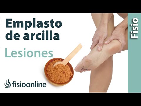 4 remedios con arcilla para curar afecciones cutáneas