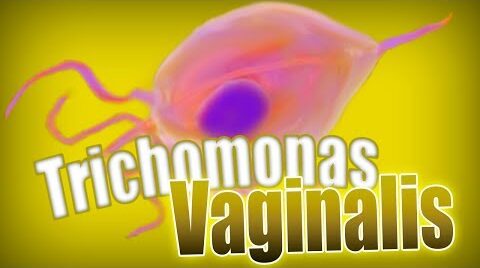 Tricomoniasis femenina: ¿se puede abordar con remedios naturales?